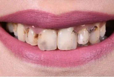 gulus-tasarimi-oncesi