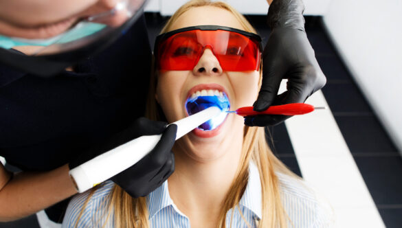 Diş Temizliği Yaptırmak Dişlere Zarar Verir Mi?